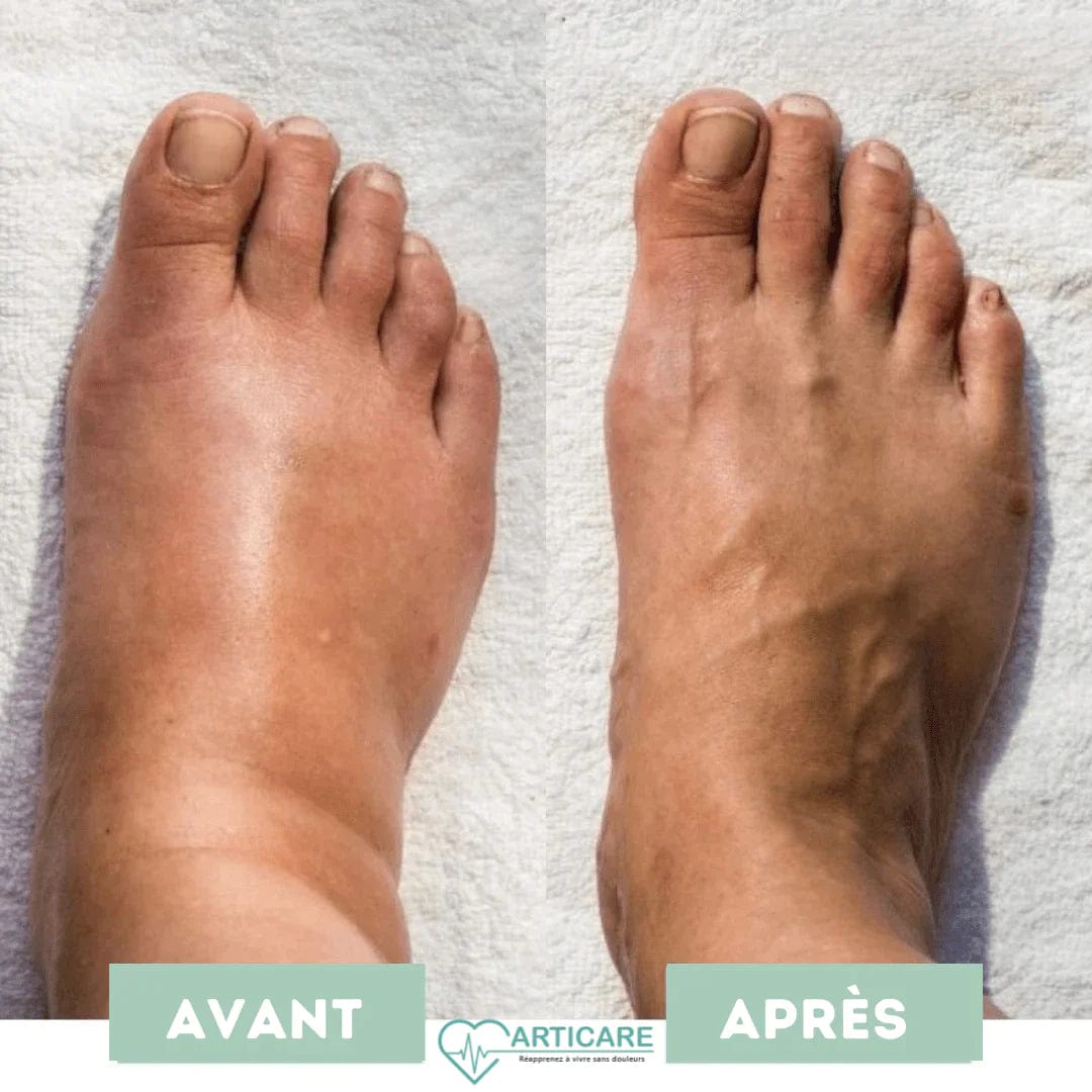 Lively® 0 Tapis de massage EMS intelligent